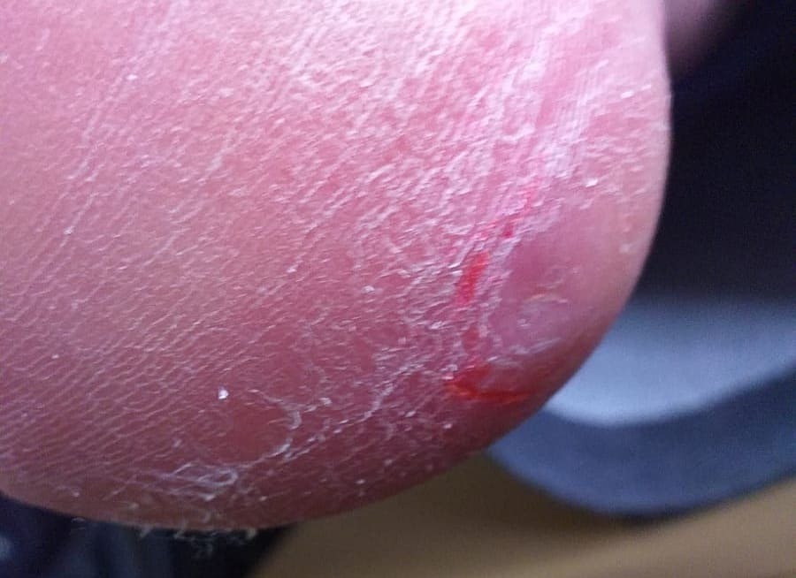 orthoplastie
