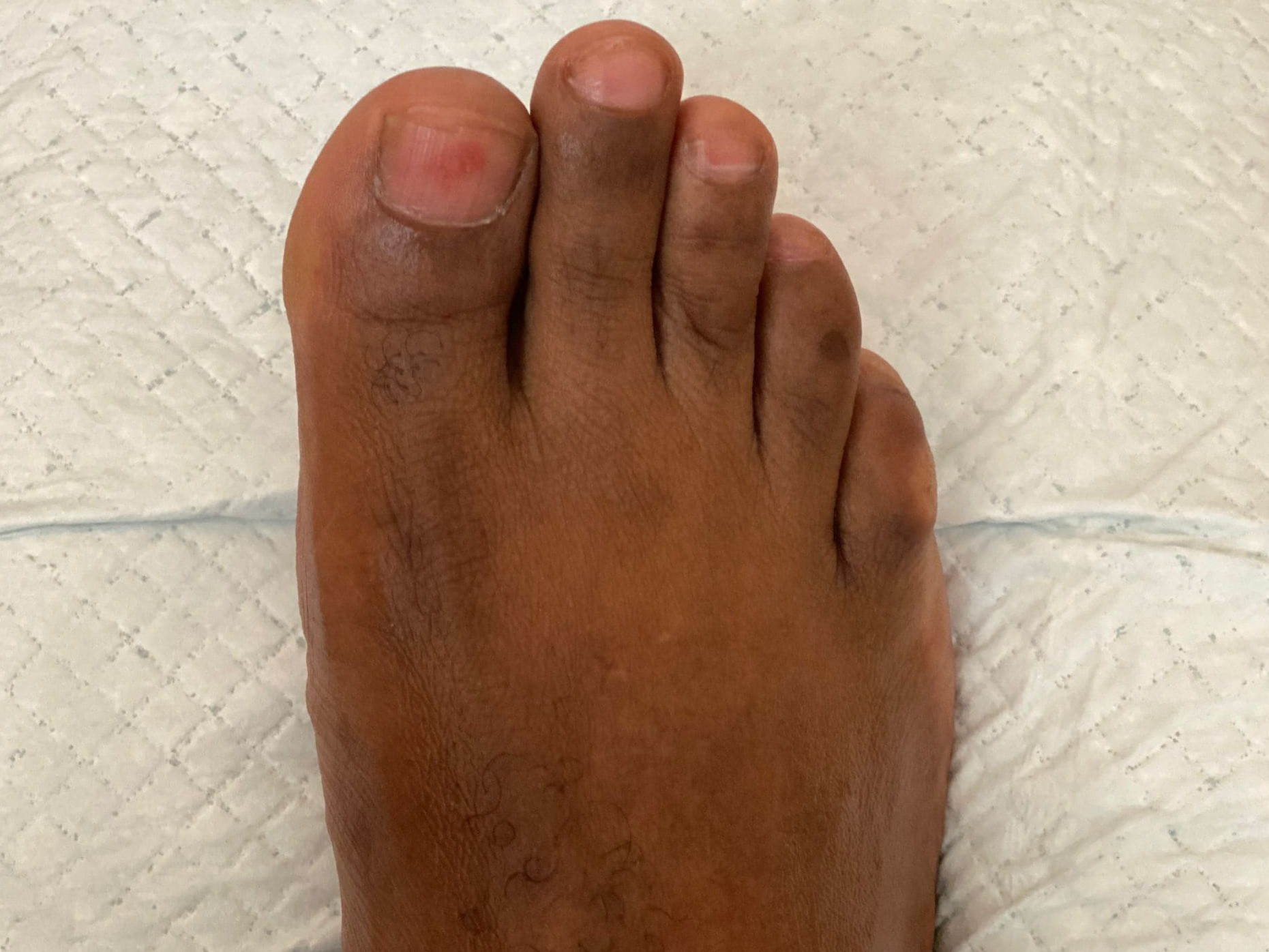 orthoplastie